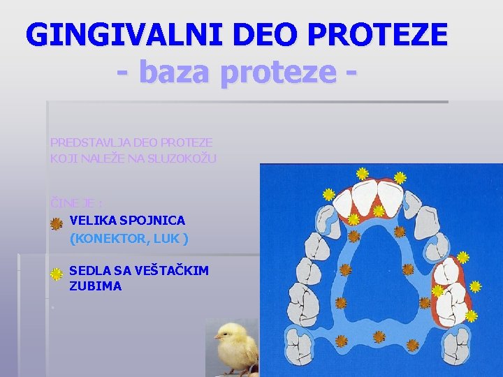 GINGIVALNI DEO PROTEZE - baza proteze PREDSTAVLJA DEO PROTEZE KOJI NALEŽE NA SLUZOKOŽU ČINE
