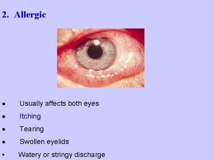 Treatment of certain Eye Conditions by Dr GL
