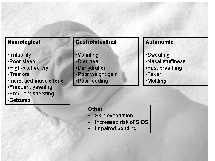 NAS: A multi-system disorder Neurological Gastrointestinal Autonomic • Irritability • Poor sleep • High-pitched