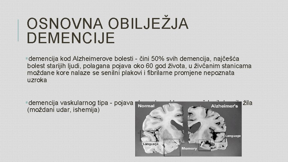 OSNOVNA OBILJEŽJA DEMENCIJE §demencija kod Alzheimerove bolesti - čini 50% svih demencija, najčešća bolest
