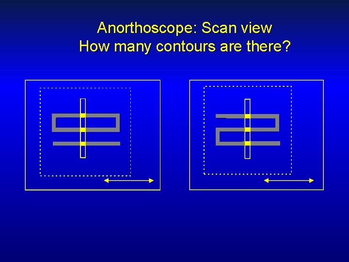 Anorthoscope: Scan view How many contours are there? 