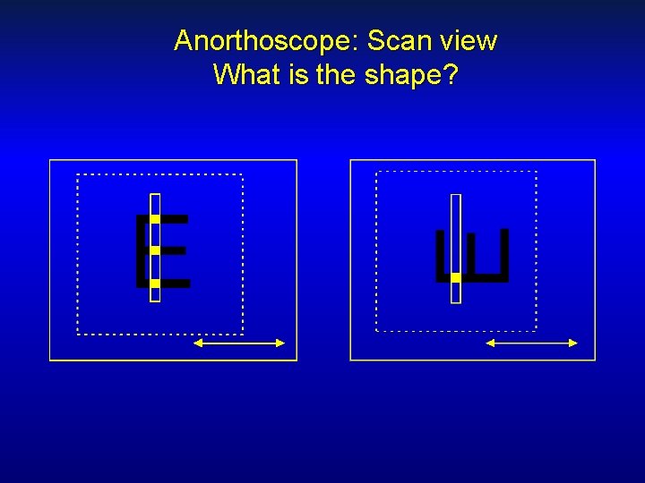 Anorthoscope: Scan view What is the shape? 