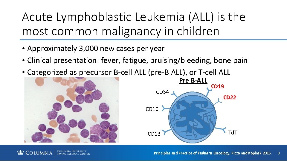 Acute Lymphoblastic Leukemia (ALL) is the most common malignancy in children • Approximately 3,
