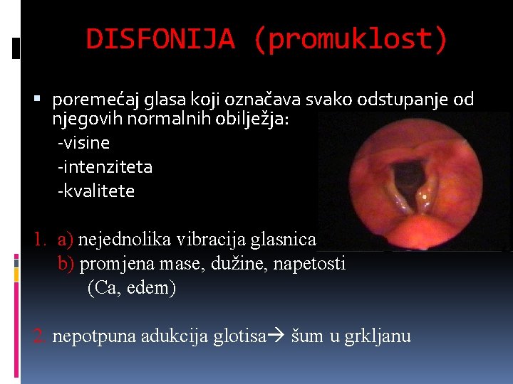 DISFONIJA (promuklost) poremećaj glasa koji označava svako odstupanje od njegovih normalnih obilježja: -visine -intenziteta