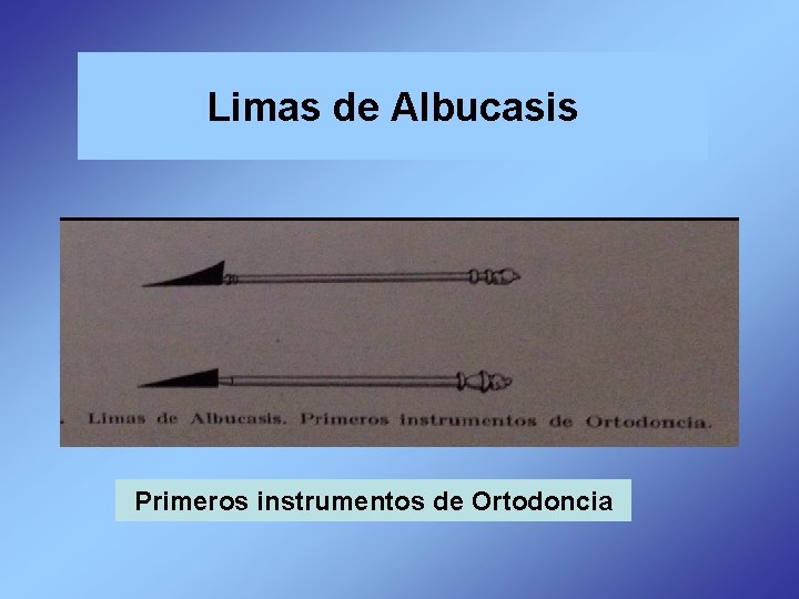 Limas de Albucasis Primeros instrumentos de Ortodoncia 