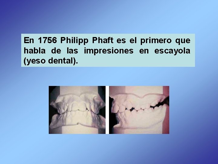 En 1756 Philipp Phaft es el primero que habla de las impresiones en escayola