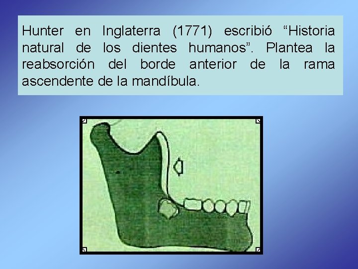 Hunter en Inglaterra (1771) escribió “Historia natural de los dientes humanos”. Plantea la reabsorción