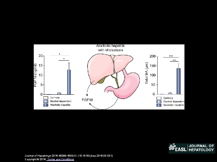 Journal of Hepatology 2018 69396 -405 DOI: (10. 1016/j. jhep. 2018. 031) Copyright ©