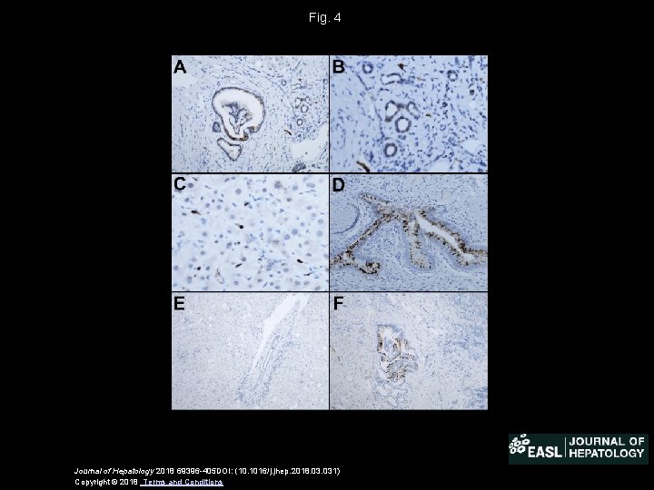 Fig. 4 Journal of Hepatology 2018 69396 -405 DOI: (10. 1016/j. jhep. 2018. 031)