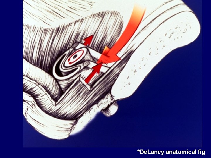 *De. Lancy anatomical fig 