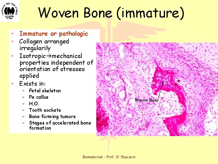 Woven Bone (immature) • Immature or pathologic • Collagen arranged irregularily • Isotropic mechanical Woven Bone (immature) • Immature or pathologic • Collagen arranged irregularily • Isotropic mechanical
