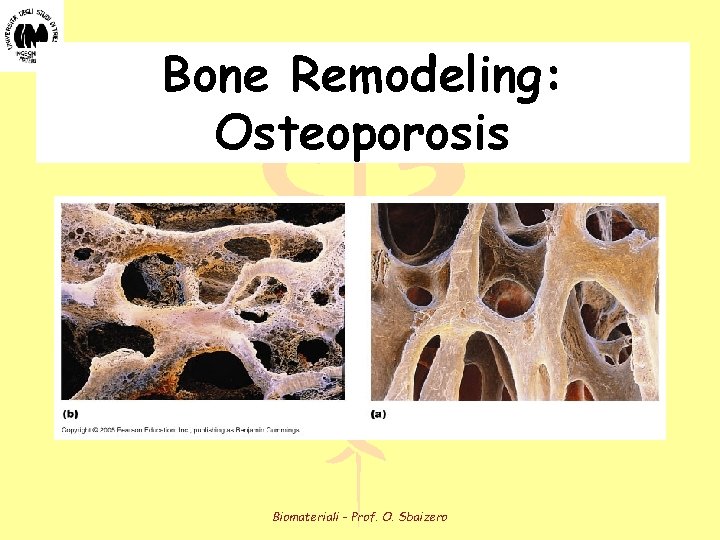 Bone Remodeling: Osteoporosis Biomateriali - Prof. O. Sbaizero 