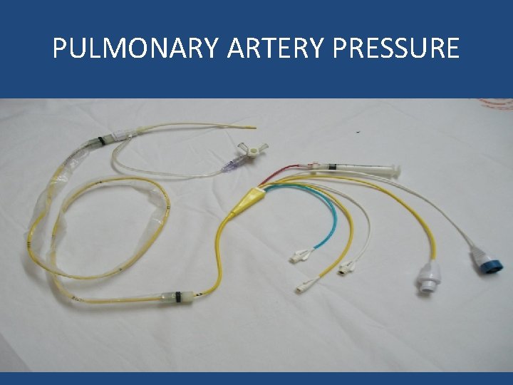 PULMONARY ARTERY PRESSURE 