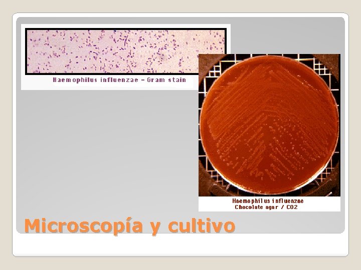Microscopía y cultivo 