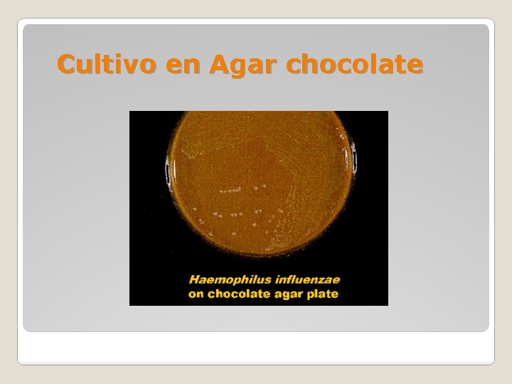 Cultivo en Agar chocolate 