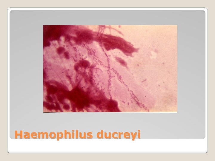 Haemophilus ducreyi 