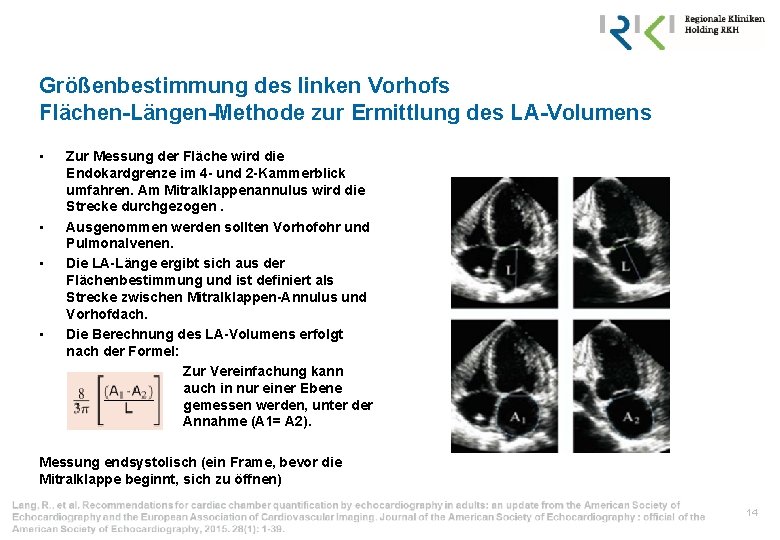 Größenbestimmung des linken Vorhofs Flächen-Längen-Methode zur Ermittlung des LA-Volumens • • Zur Messung der