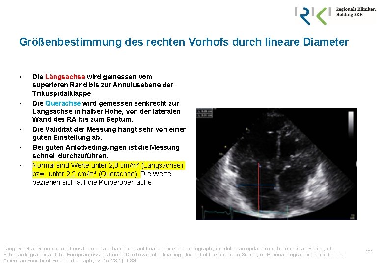 Größenbestimmung des rechten Vorhofs durch lineare Diameter • • • Die Längsachse wird gemessen