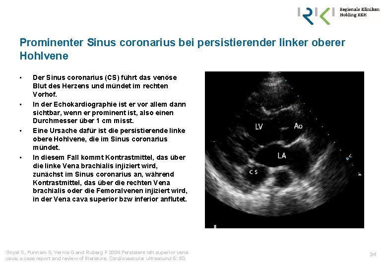 Prominenter Sinus coronarius bei persistierender linker oberer Hohlvene • • Der Sinus coronarius (CS)