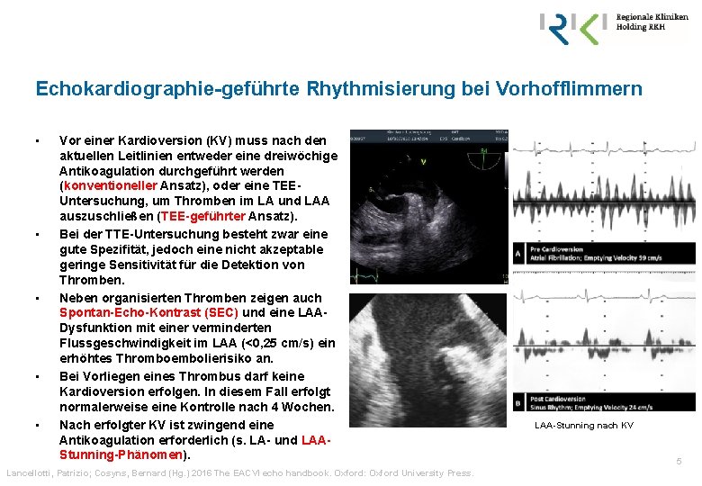 Echokardiographie-geführte Rhythmisierung bei Vorhofflimmern • • • Vor einer Kardioversion (KV) muss nach den