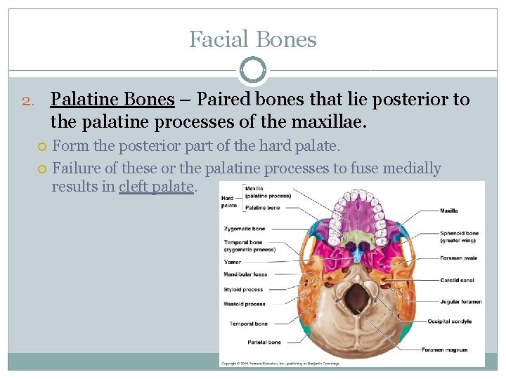 Facial Bones 2. Palatine Bones – Paired bones that lie posterior to the palatine