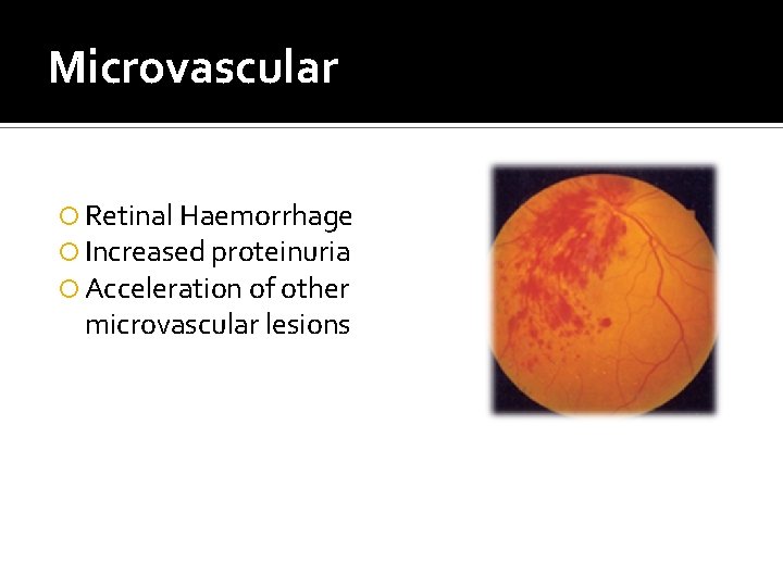 Microvascular Retinal Haemorrhage Increased proteinuria Acceleration of other microvascular lesions 