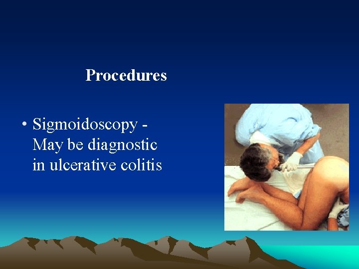  Procedures • Sigmoidoscopy - May be diagnostic in ulcerative colitis 