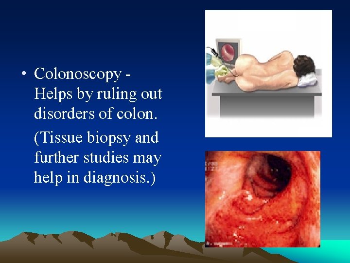  • Colonoscopy - Helps by ruling out disorders of colon. (Tissue biopsy and