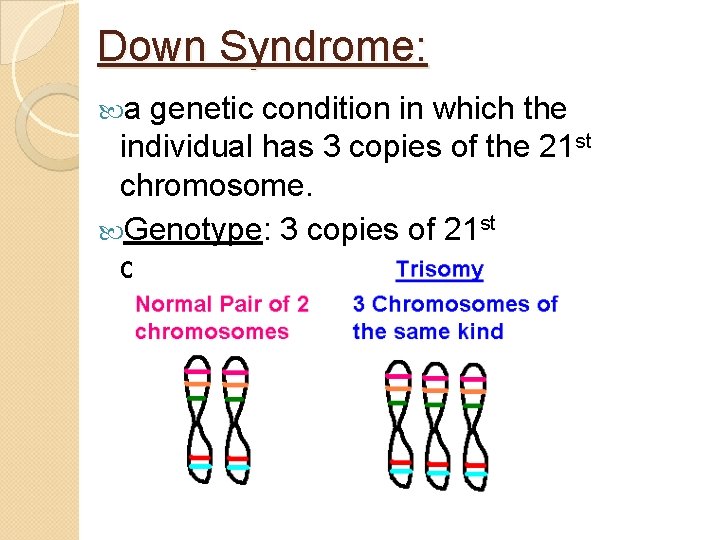 Down Syndrome: a genetic condition in which the individual has 3 copies of the