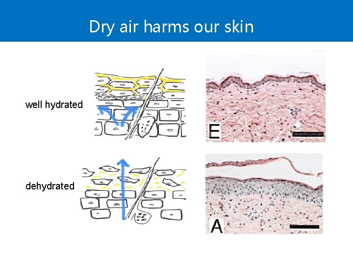 Dry air harms our skin well hydrated dehydrated 