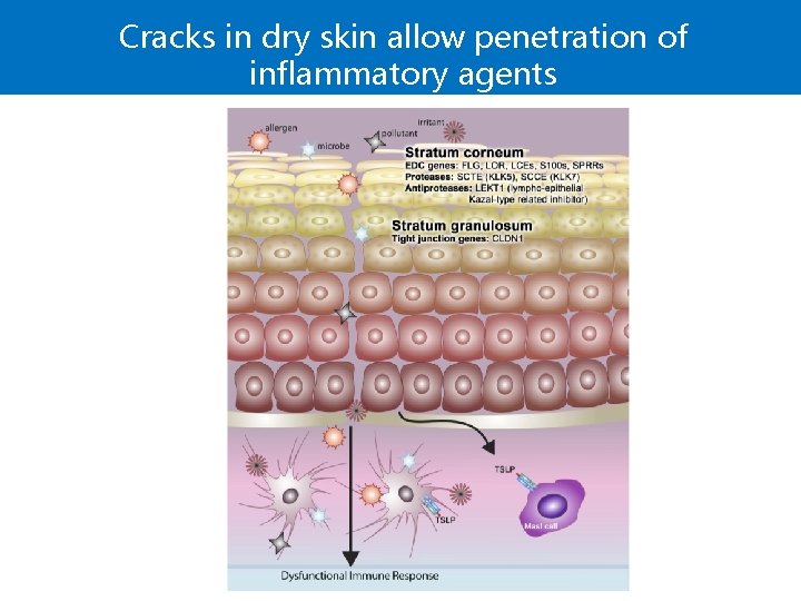 Cracks in dry skin allow penetration of inflammatory agents 