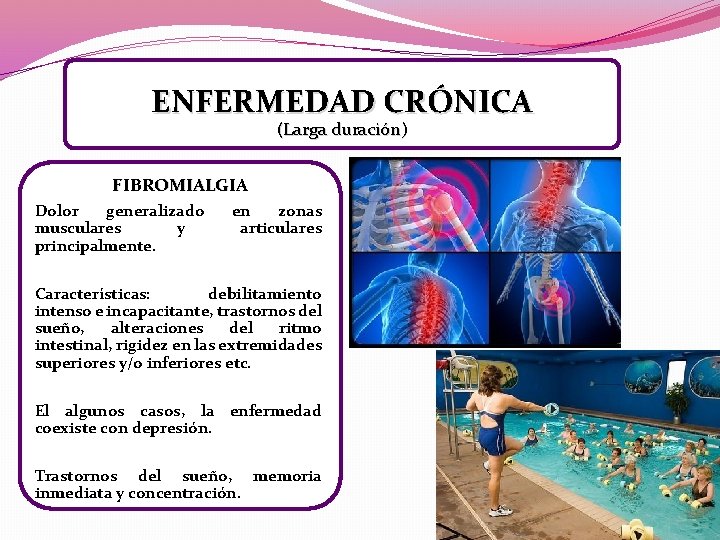 ENFERMEDAD CRÓNICA (Larga duración) FIBROMIALGIA Dolor generalizado musculares y principalmente. en zonas articulares Características: