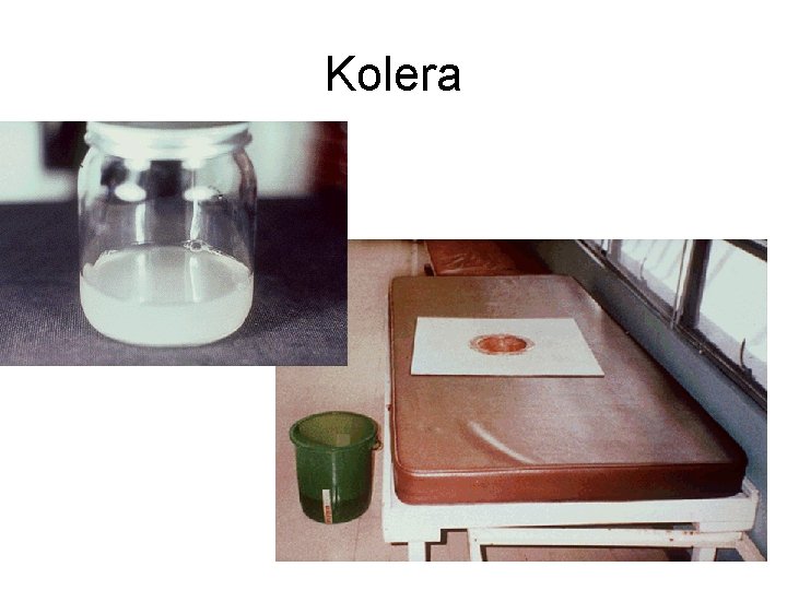 Kolera 