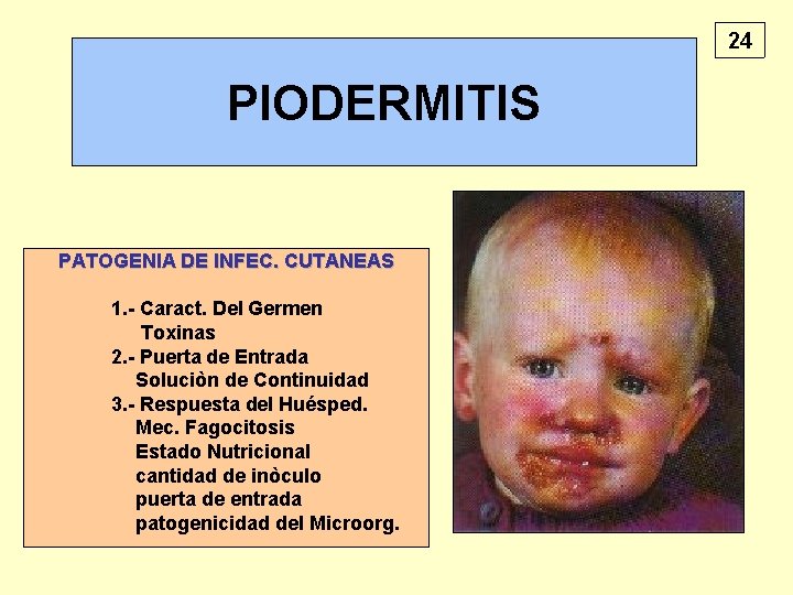 24 PIODERMITIS PATOGENIA DE INFEC. CUTANEAS 1. - Caract. Del Germen Toxinas 2. -