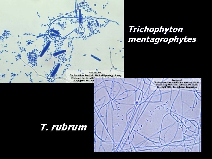 Trichophyton mentagrophytes T. rubrum 