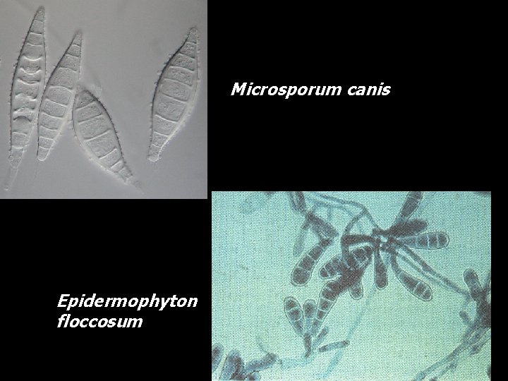 Microsporum canis Epidermophyton floccosum 