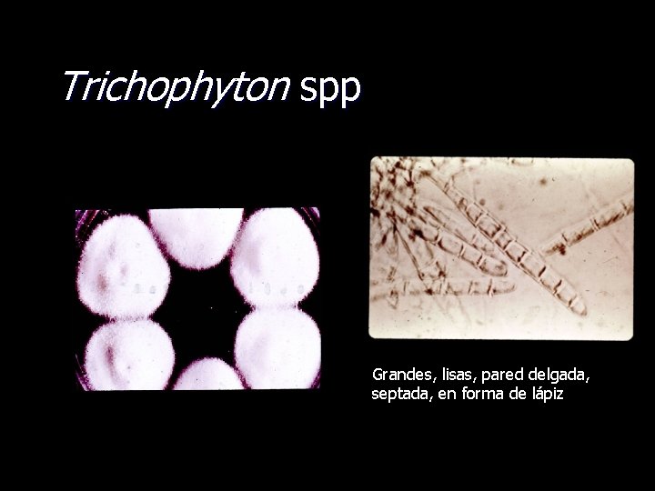 Trichophyton spp Grandes, lisas, pared delgada, septada, en forma de lápiz 