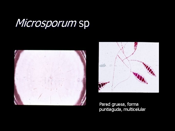 Microsporum sp Pared gruesa, forma puntiaguda, multicelular 
