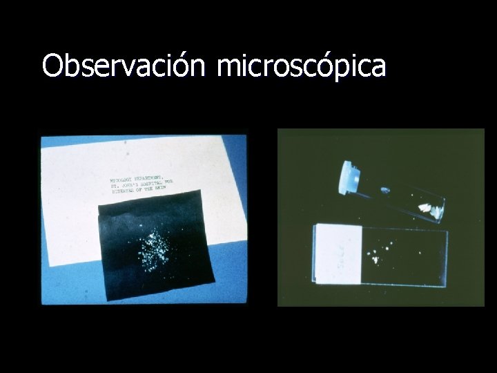 Observación microscópica 