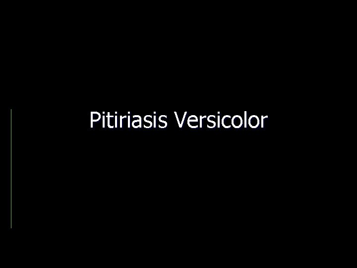 Pitiriasis Versicolor 