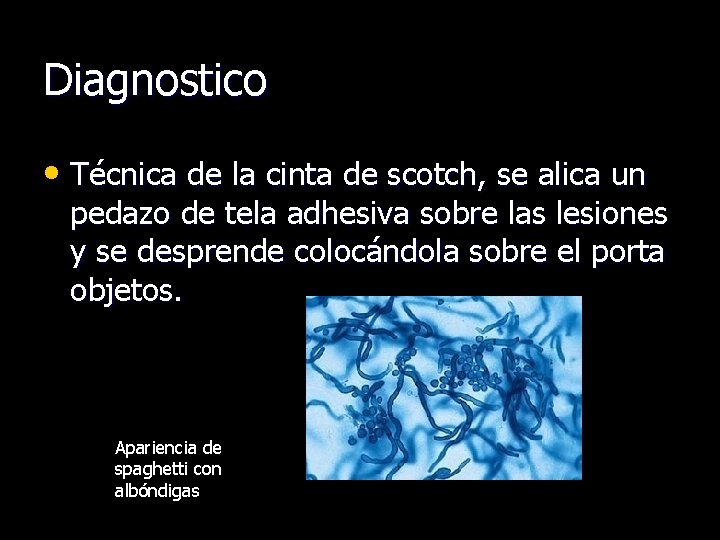 Diagnostico • Técnica de la cinta de scotch, se alica un pedazo de tela