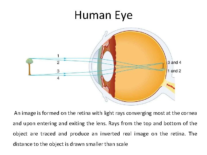 Human Eye An image is formed on the retina with light rays converging most