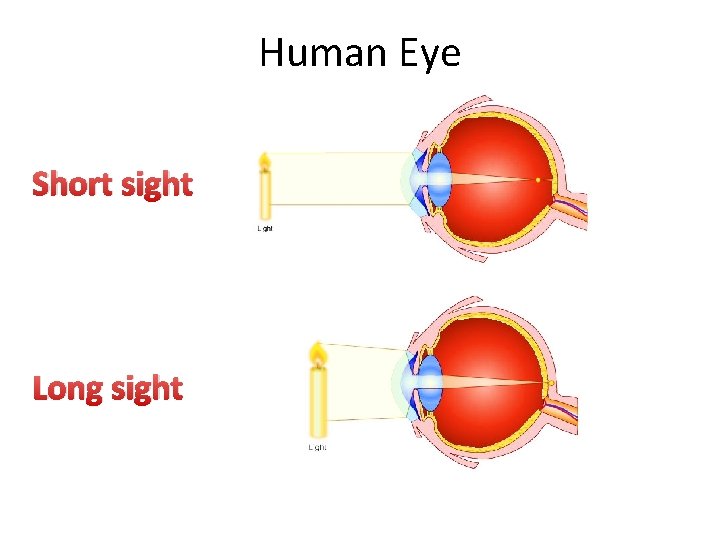 Human Eye Short sight Long sight 