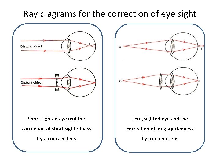 Ray diagrams for the correction of eye sight Short sighted eye and the Long