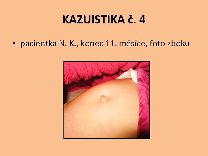 KAZUISTIKA č. 4 • pacientka N. K. , konec 11. měsíce, foto zboku 