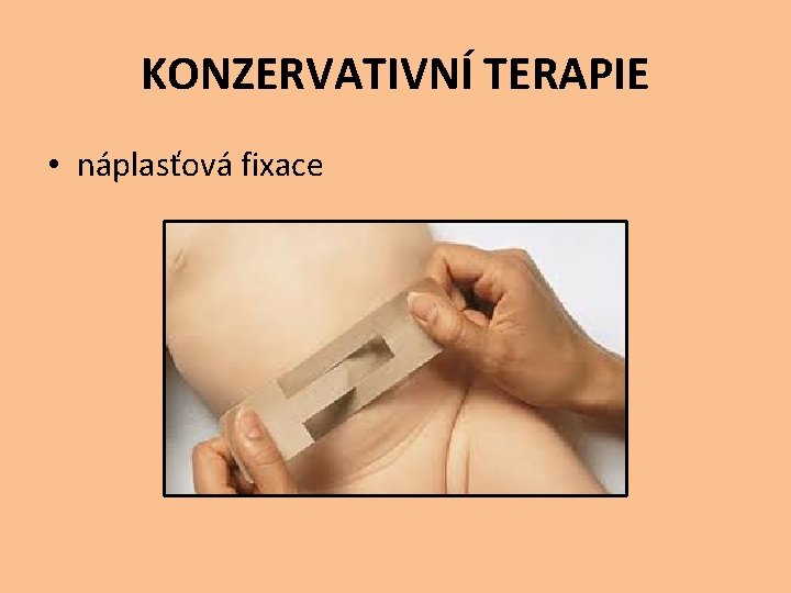 KONZERVATIVNÍ TERAPIE • náplasťová fixace 