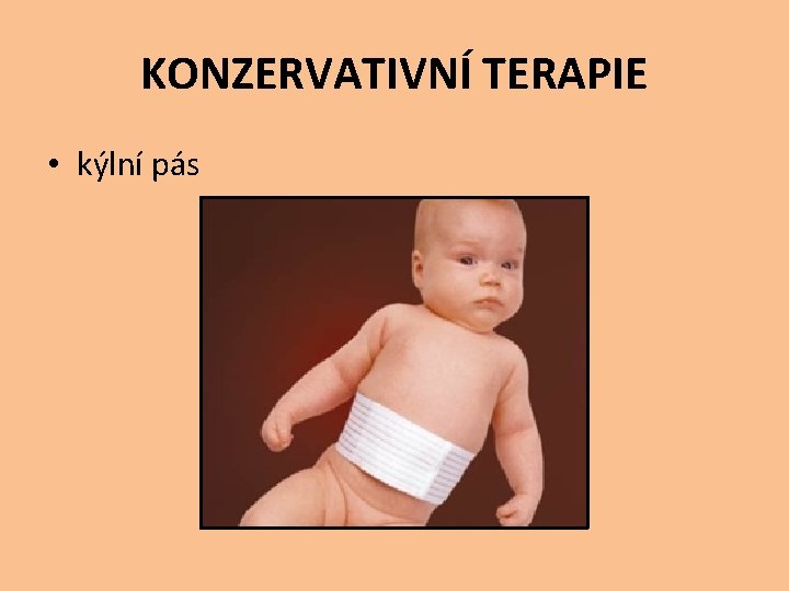 KONZERVATIVNÍ TERAPIE • kýlní pás 