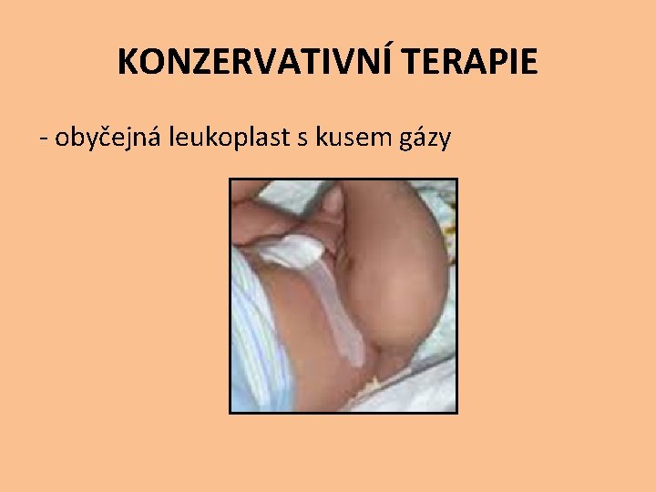 KONZERVATIVNÍ TERAPIE - obyčejná leukoplast s kusem gázy 