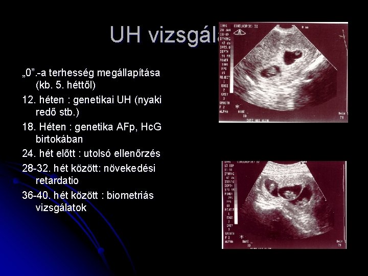 UH vizsgálatok „ 0”. -a terhesség megállapítása (kb. 5. héttől) 12. héten : genetikai