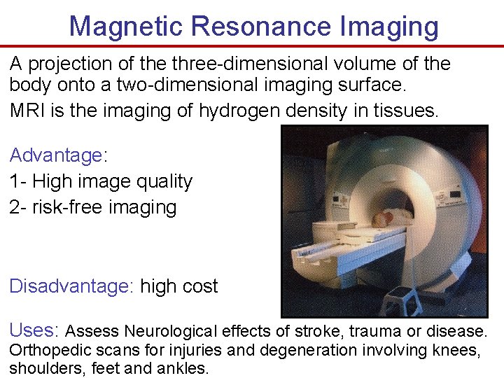 Magnetic Resonance Imaging A projection of the three-dimensional volume of the body onto a